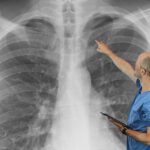 The Hidden Toxin Choking Your Lungs (And the 7-Second Fix Doctors Won’t Tell You)
