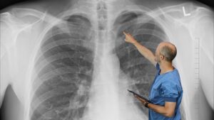 The Hidden Toxin Choking Your Lungs (And the 7-Second Fix Doctors Won’t Tell You)