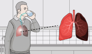 COPD morning routine to clear lungs, 7 second lung exercise for mucus, doctor-approved COPD natural remedy, how to stop wheezing in the morning, best breathing technique for COPD, mucus clearing ritual for lungs