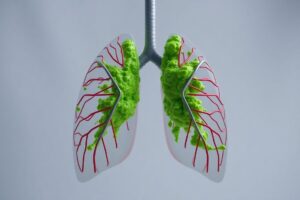 - self-test for mucus buildup in lungs, - am I coughing up too much phlegm, - difference between normal cough and lung congestion, - when to worry about morning coughing, - lung butter symptom checker, - how to tell if mucus is in your airways