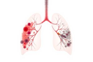Side-by-side comparison illustration showing lung damage from vaping versus traditional smoking