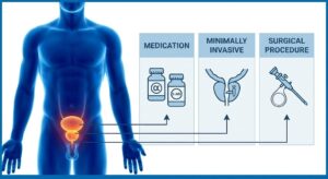Infographic comparing BPH treatment pathways: medications, minimally invasive procedures, and surgery options."