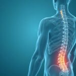 Illustration showing the spine and common sources of back pain